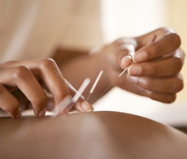The Best Acupuncture Schools